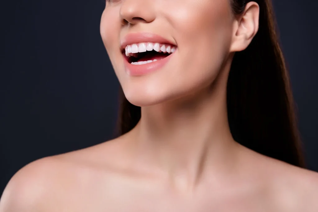 affordable veneers athens ga