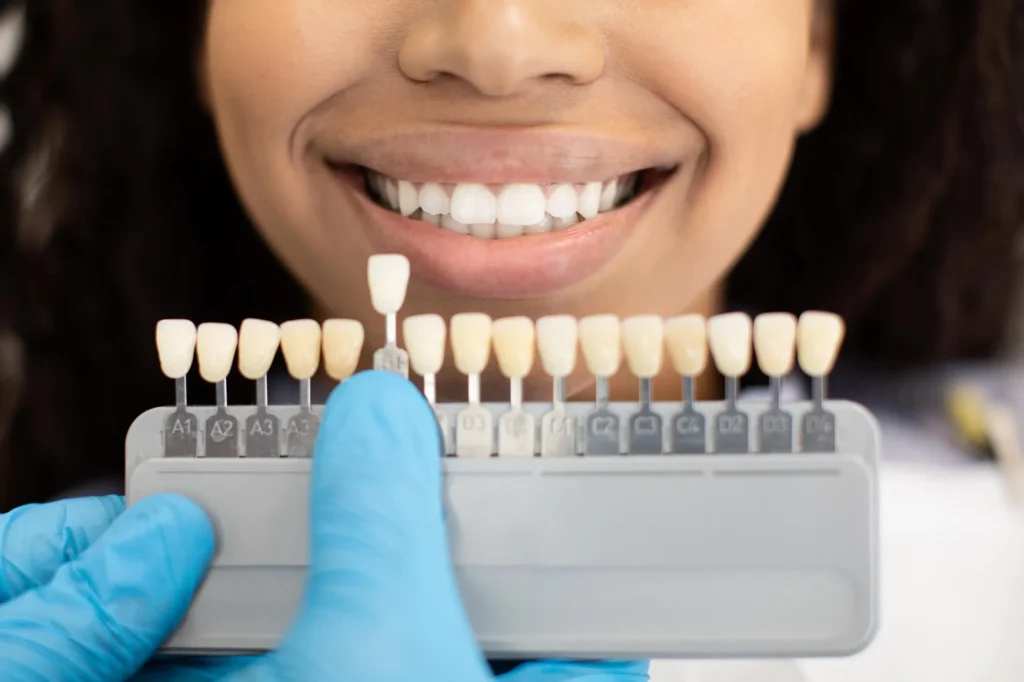 patient choosing a shade for her veneers athens ga