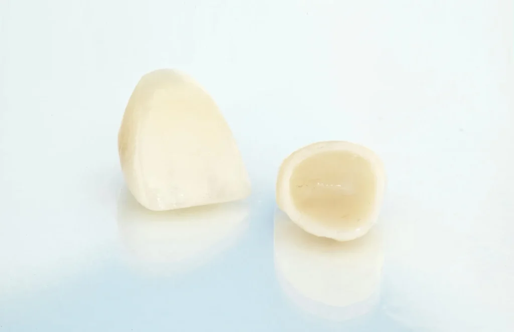 dental crowns athens