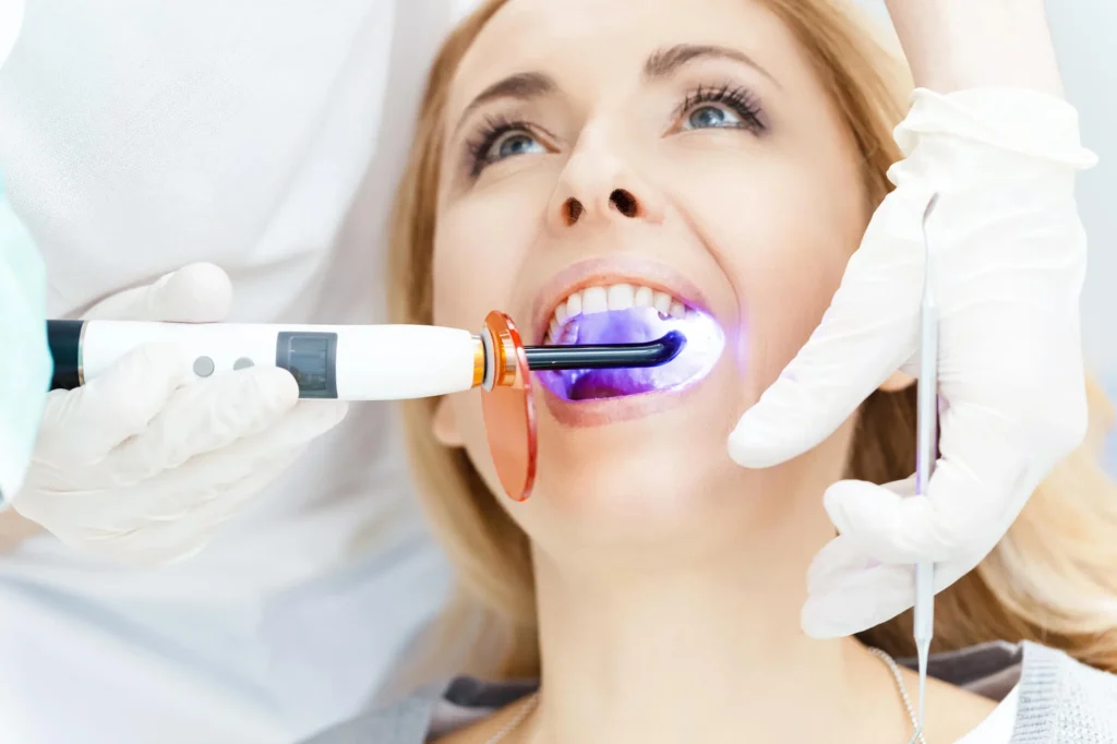 ongoing teeth whitening athens ga