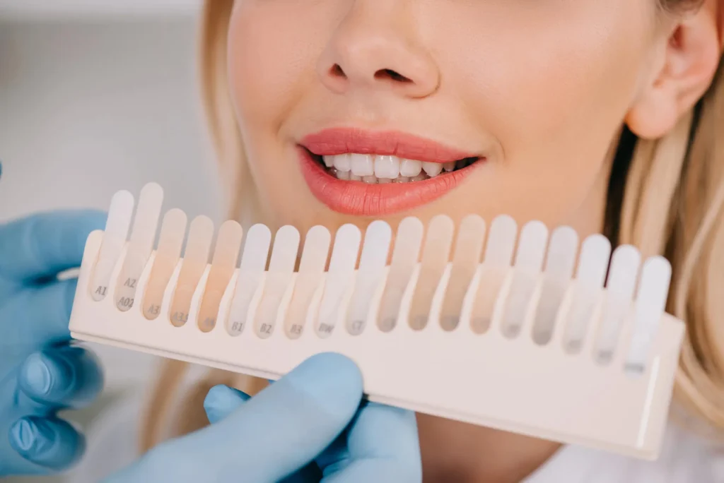 patient for teeth whitening athens ga