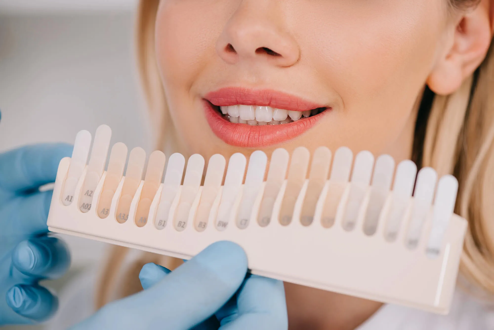 patient for teeth whitening athens ga