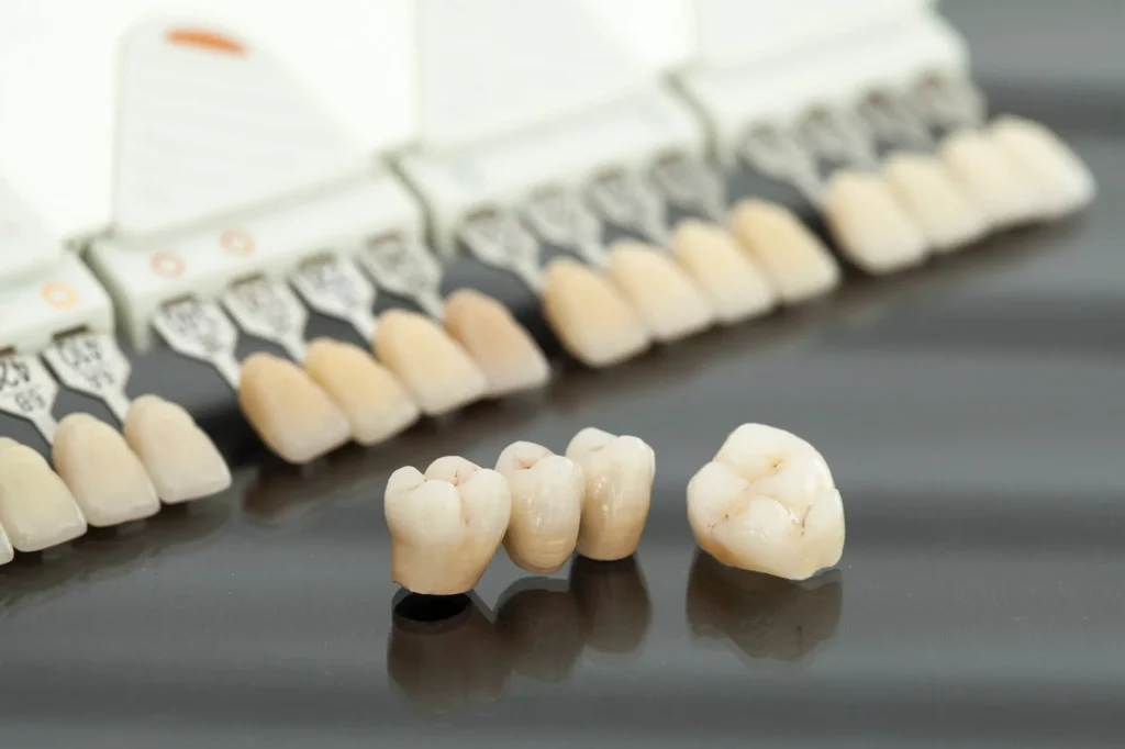 sample dental crowns athens