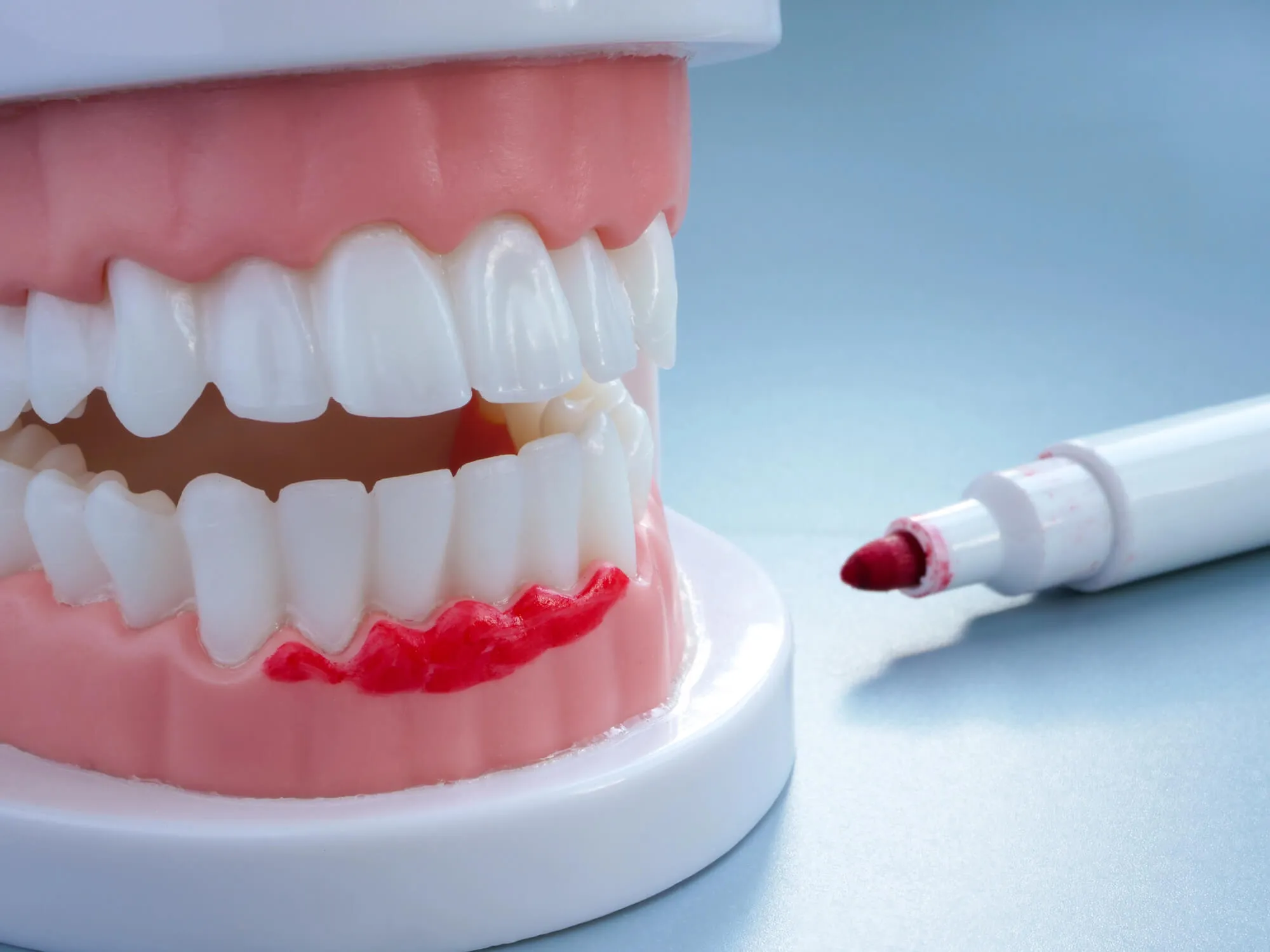 dentists-in-watkinsville-ga-shows-a-mouth-model