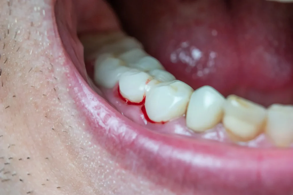 patient-needs-to-see-dentists-in-watkinsville-ga